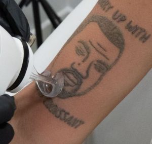US Tattoo Studio Is Removing Kanye West Tattoos For Free