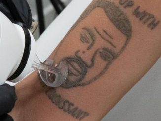 US Tattoo Studio Is Removing Kanye West Tattoos For Free