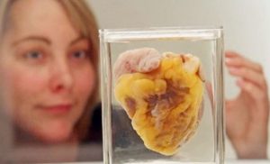 Woman Sees Her Own Heart On Display at Museum, 16 Years After Transplant Surgery